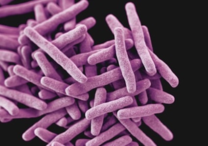 Mycobacterium tuberculosis